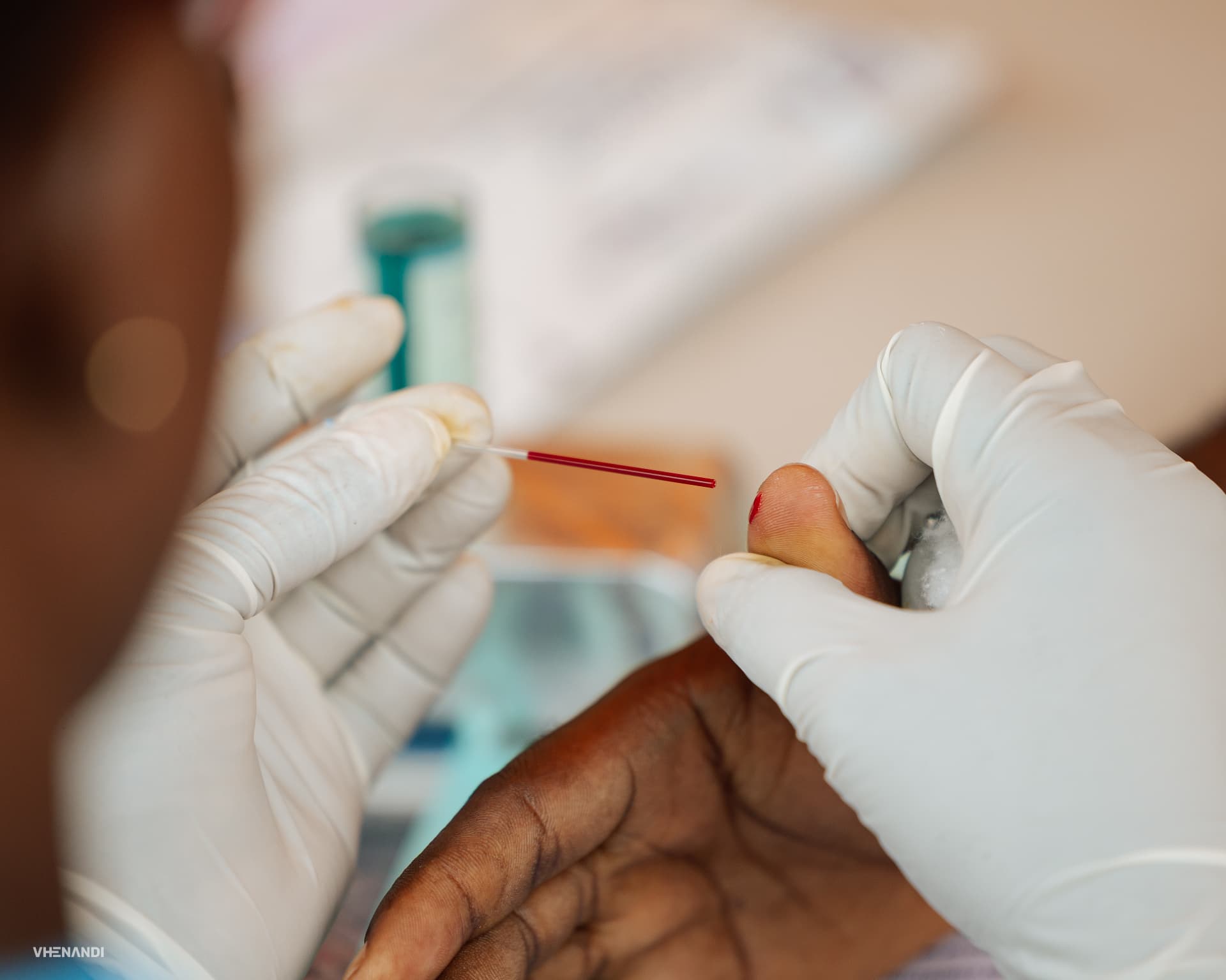 A healthcare worker preparing a donor's finger for screening at a Bloodline drive